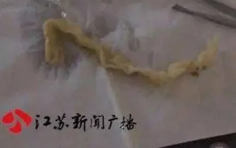 隆鼻子要多少钱，隆鼻子大概多少费用