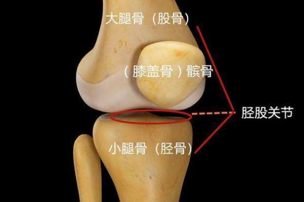 女孩大腿骨溶解为保腿花费几十万还负债 骨溶解症是什么病