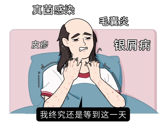 头发隔多久洗一次才好？不同发质要怎么洗？看完不再纠结