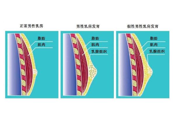 11周岁乳房 种类图片