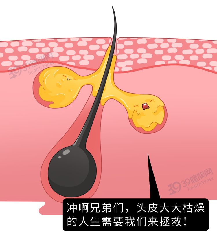 头发多久洗一次最好？天天洗头更容易出油？标准答案来了