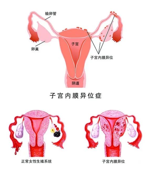 为什么女朋友总是喊疼？