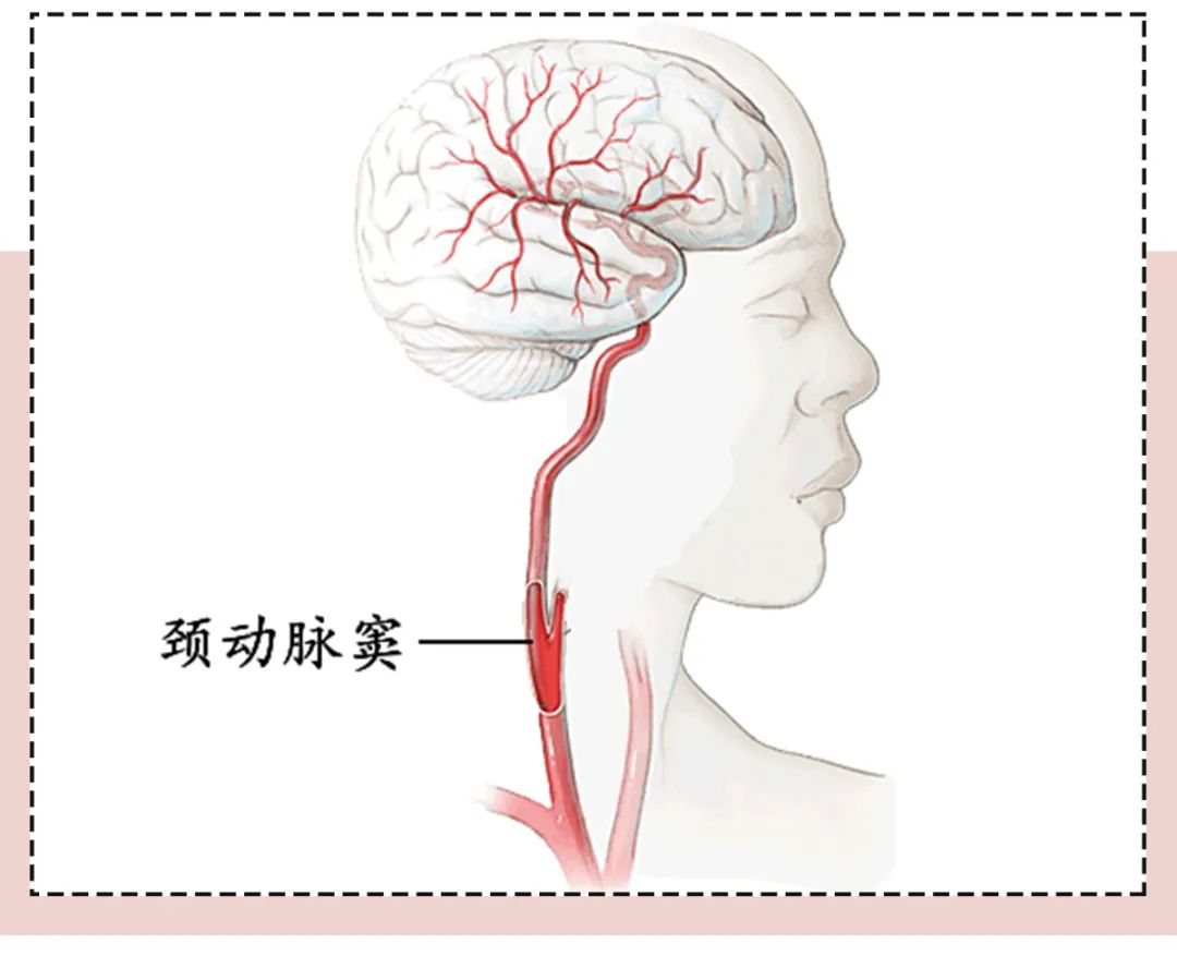 「种草莓」怎么“嘬”最刺激？