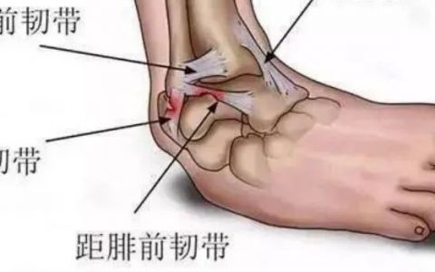 你的脚为什么总是崴到？