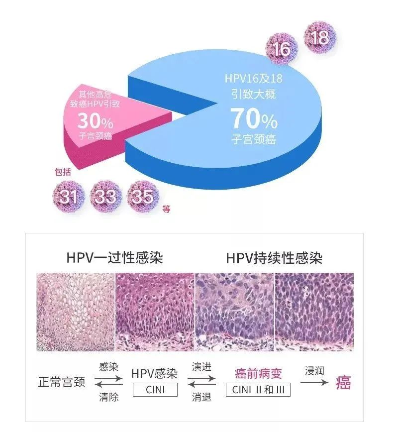 沈阳哪个医院可以打hpv疫苗，沈阳治HPV最权威的医院