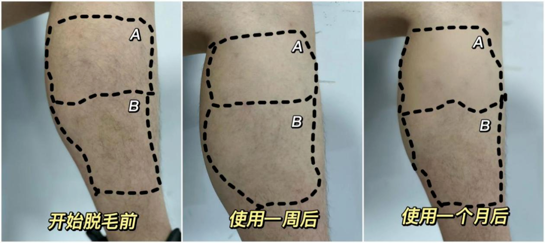 我大胆尝试和TA口爱，结果……